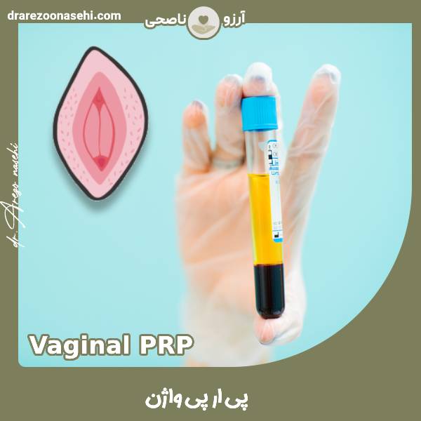 پی آر پی واژن - دکتر آرزو ناصحی