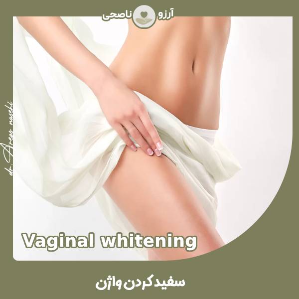 سفید کردن واژن - دکتر آرزو ناصحی