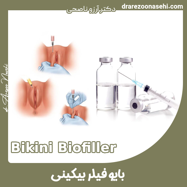 بایوفیلر بیکینی - دکتر آرزو ناصحی