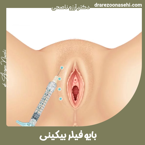 بایوفیلر بیکینی - دکتر آرزو ناصحی