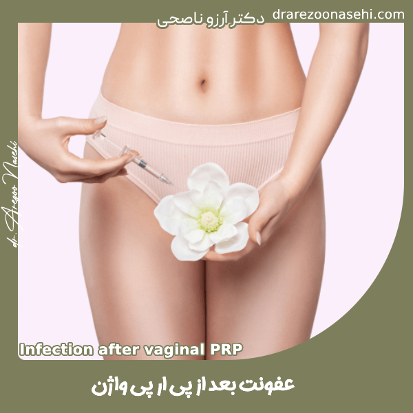 عفونت بعد از پی‌ آر پی واژن - دکتر آرزو ناصحی