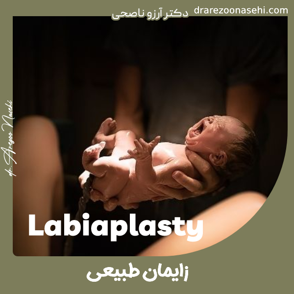 زایمان طبیعی - دکتر آرزو ناصحی