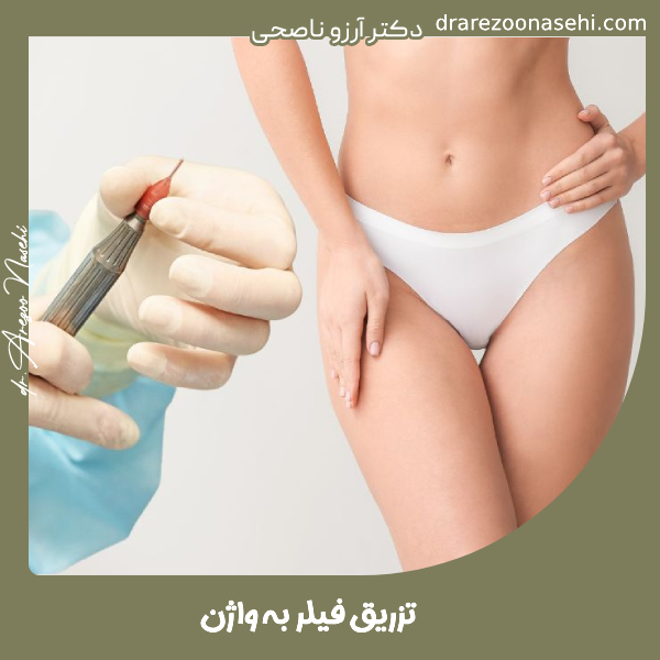 تزریق فیلر به واژن - دکتر آرزو ناصحی
