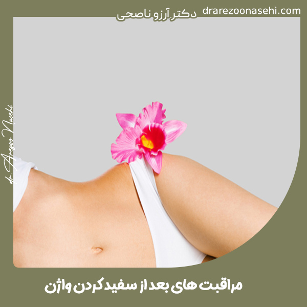مراقبت های بعد از سفید کردن واژن - دکتر آرزو ناصحی